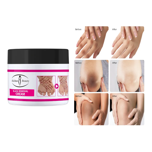 AICHUN BEAUTY, CREMA BLANQUEADORA DE ARTICULACIONES PARA ELIMINAR MANCHAS, RODILLAS Y CODOS OSCUROS